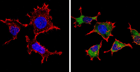 Immunocytochemistry/ Immunofluorescence - Anti-Endostatin/COL18A1 antibody (AB3453), expandable thumbnail