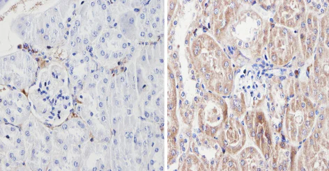 Immunohistochemistry (Formalin/PFA-fixed paraffin-embedded sections) - Anti-Endostatin/COL18A1 antibody (AB3453)