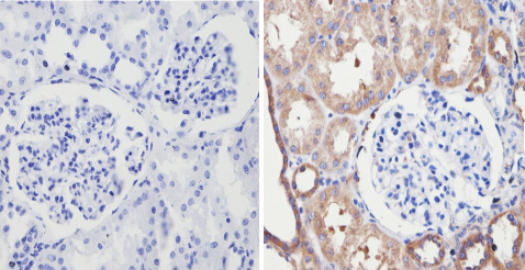 Immunohistochemistry (Formalin/PFA-fixed paraffin-embedded sections) - Anti-Endostatin/COL18A1 antibody (AB3453), expandable thumbnail
