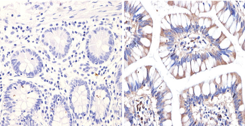 Immunohistochemistry (Formalin/PFA-fixed paraffin-embedded sections) - Anti-Endostatin/COL18A1 antibody (AB3453), expandable thumbnail