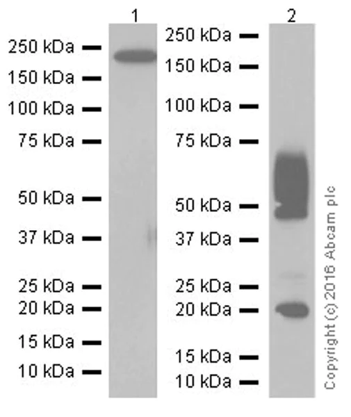 Western blot - Anti-Endostatin/COL18A1 antibody [EPR19995] (AB207162)