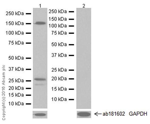 Western blot - Anti-Endostatin/COL18A1 antibody [EPR19995] (AB207162)