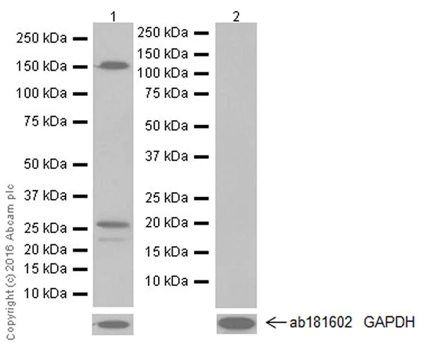 Western blot - Anti-Endostatin/COL18A1 antibody [EPR19995] (AB207162)