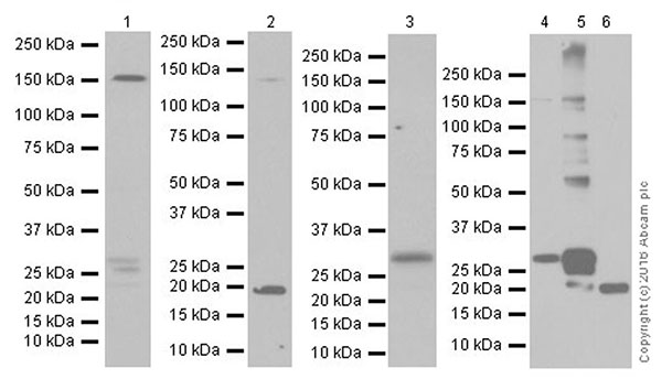 Western blot - Anti-Endostatin/COL18A1 antibody [EPR19995] - BSA and Azide free (AB251463)