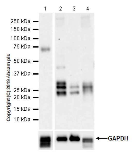 Western blot - Anti-Endostatin/COL18A1 antibody [EPR22479-279] (AB255601)