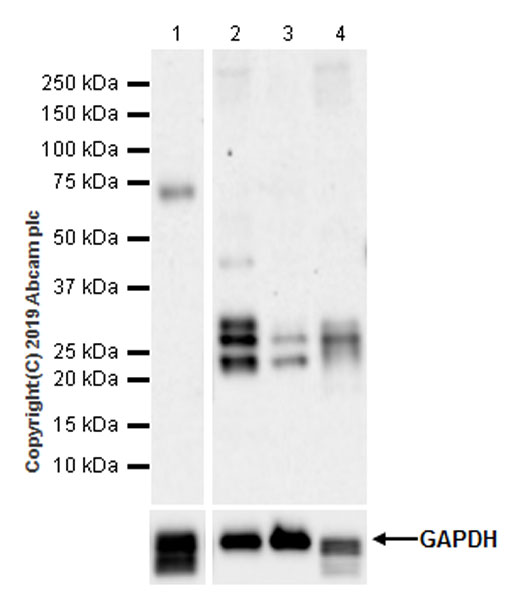 Western blot - Anti-Endostatin/COL18A1 antibody [EPR22479-279] - BSA and Azide free (AB256508)