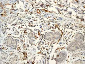 Immunohistochemistry (Formalin/PFA-fixed paraffin-embedded sections) - Endothelial Cell Marker (CD31, CD34, ICAM1, CD45) Antibody Sampler Panel - Human (AB254023)