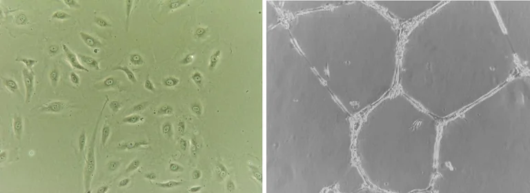 Functional Studies - Endothelial Tube Formation Assay (In Vitro Angiogenesis Assay) (AB325584)