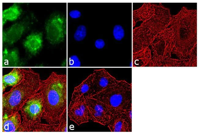 Immunocytochemistry - Anti-Endothelin 1 antibody (AB117757)
