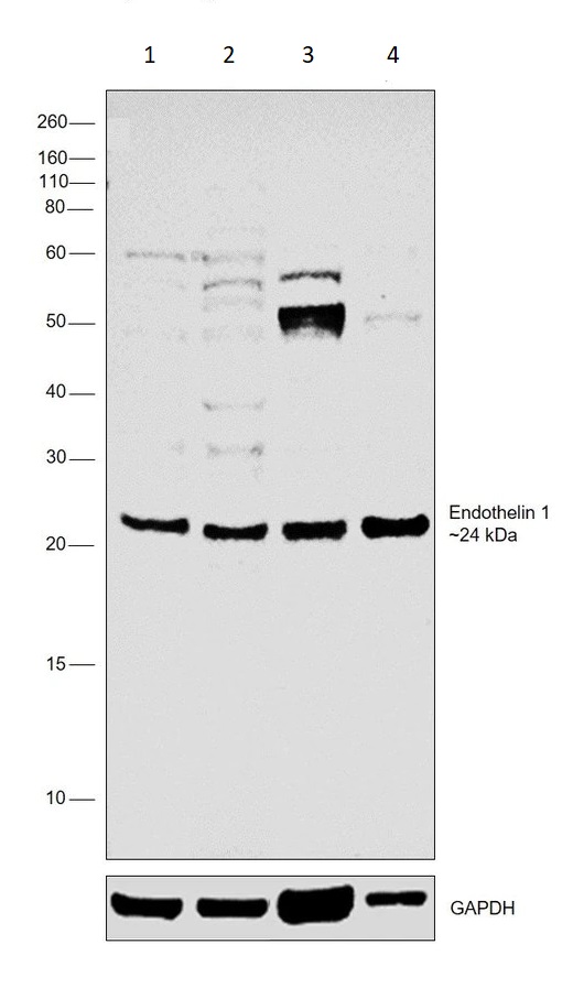 Western blot - Anti-Endothelin 1 antibody (AB117757)