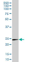 Western blot - Anti-Endothelin 1 antibody (AB88093)