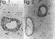 Immunohistochemistry (Formalin/PFA-fixed paraffin-embedded sections) - Anti-Endothelin 1 antibody [TR.ET.48.5] (ab2786), expandable thumbnail