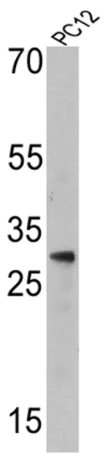Western blot - Anti-Endothelin 1 antibody [TR.ET.48.5] (AB2786)