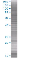 SDS-PAGE - Endothelin 1 overexpression 293T lysate (whole cell) (AB94258)