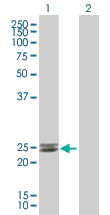 Western blot - Endothelin 1 overexpression 293T lysate (whole cell) (AB94258)