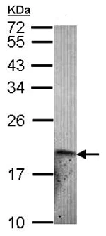 Western blot - Anti-Endothelin 2/ET-2 antibody (AB153867)