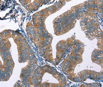 Immunohistochemistry (Formalin/PFA-fixed paraffin-embedded sections) - Anti-Endothelin 2/ET-2 antibody (AB197763)