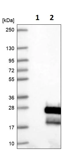 Western blot - Anti-Endothelin 2/ET-2 antibody (AB246962)