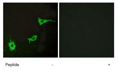 Immunocytochemistry/ Immunofluorescence - Anti-Endothelin A Receptor/ET-A antibody (AB76259)