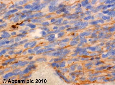 Immunohistochemistry (Formalin/PFA-fixed paraffin-embedded sections) - Anti-Endothelin A Receptor/ET-A antibody (AB76259)