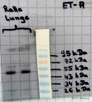 Western blot - Anti-Endothelin A Receptor/ET-A antibody (AB85163)