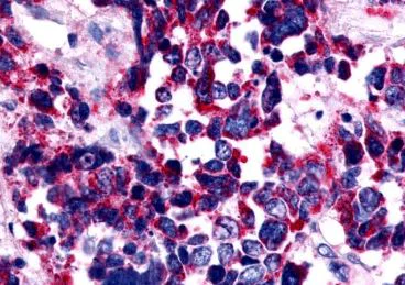 Immunohistochemistry (Formalin/PFA-fixed paraffin-embedded sections) - Anti-Endothelin A Receptor/ET-A antibody - Extracellular domain (AB219358)