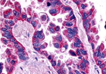 Immunohistochemistry (Formalin/PFA-fixed paraffin-embedded sections) - Anti-Endothelin A Receptor/ET-A antibody - Extracellular domain (AB219358)