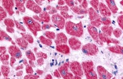 Immunohistochemistry (Formalin/PFA-fixed paraffin-embedded sections) - Anti-Endothelin A Receptor/ET-A antibody - Extracellular domain (AB219358)