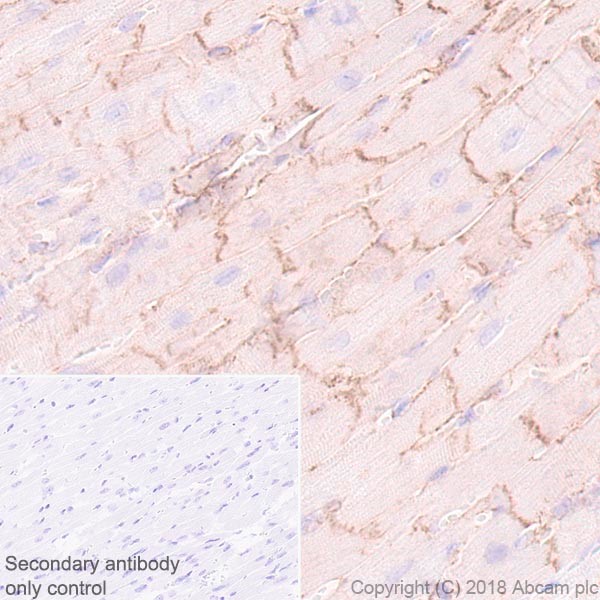 Immunohistochemistry (Formalin/PFA-fixed paraffin-embedded sections) - Anti-Endothelin A Receptor/ET-A antibody [UMB-8-37-1] (AB178454), expandable thumbnail