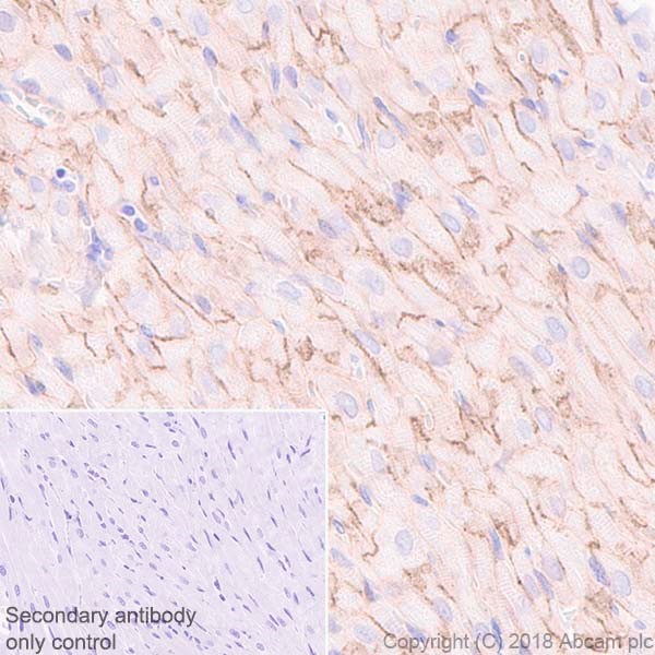 Immunohistochemistry (Formalin/PFA-fixed paraffin-embedded sections) - Anti-Endothelin A Receptor/ET-A antibody [UMB-8-37-1] (AB178454), expandable thumbnail