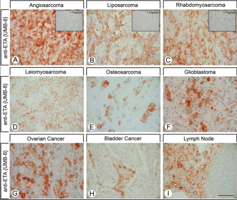 Immunohistochemistry (Formalin/PFA-fixed paraffin-embedded sections) - Anti-Endothelin A Receptor/ET-A antibody [UMB-8-37-1] (AB178454), expandable thumbnail