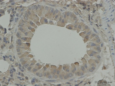 Immunohistochemistry (Formalin/PFA-fixed paraffin-embedded sections) - Anti-Endothelin B Receptor/ET-B antibody (AB117529), expandable thumbnail