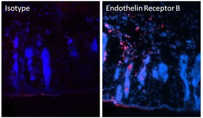 Immunohistochemistry (Frozen sections) - Anti-Endothelin B Receptor/ET-B antibody (AB117529)
