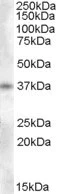 Western blot - Anti-Enkephalin/ENK antibody (AB77273)