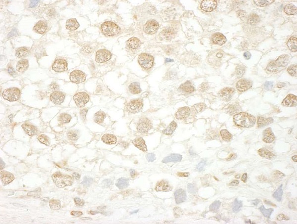 Immunohistochemistry (Formalin/PFA-fixed paraffin-embedded sections) - Anti-ENL antibody (AB245520)