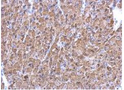Immunohistochemistry (Formalin/PFA-fixed paraffin-embedded sections) - Anti-ENO1 antibody (AB126136), expandable thumbnail