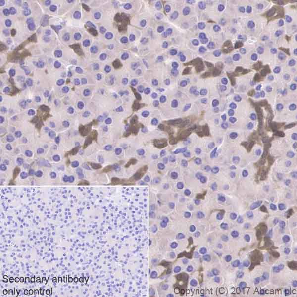 Immunohistochemistry (Formalin/PFA-fixed paraffin-embedded sections) - Anti-ENO1 antibody [EPR19758] (AB227978)