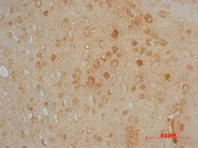 Immunohistochemistry (Formalin/PFA-fixed paraffin-embedded sections) - Anti-ENO1 + ENO2 + ENO3 antibody (AB53025)