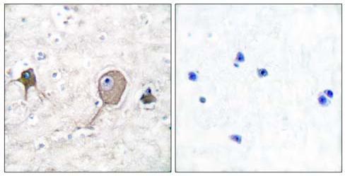 Immunohistochemistry (Formalin/PFA-fixed paraffin-embedded sections) - Anti-ENO1 + ENO2 + ENO3 antibody (AB53025)
