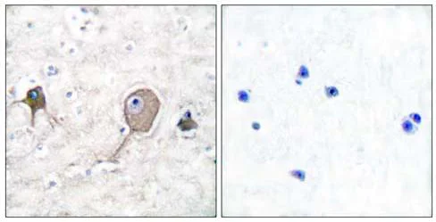 Immunohistochemistry (Formalin/PFA-fixed paraffin-embedded sections) - Anti-ENO1 + ENO2 + ENO3 antibody (AB53025)