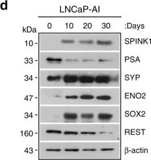 Western blot - Anti-ENO1 + ENO2 + ENO3 antibody (AB53025)