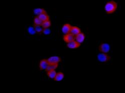 Immunocytochemistry/ Immunofluorescence - Anti-ENO1 + ENO2 + ENO3 antibody [EPR10863(B)] (AB155102)