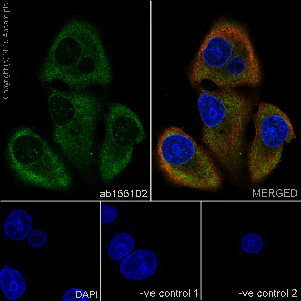 Immunocytochemistry/ Immunofluorescence - Anti-ENO1 + ENO2 + ENO3 antibody [EPR10863(B)] (AB155102)