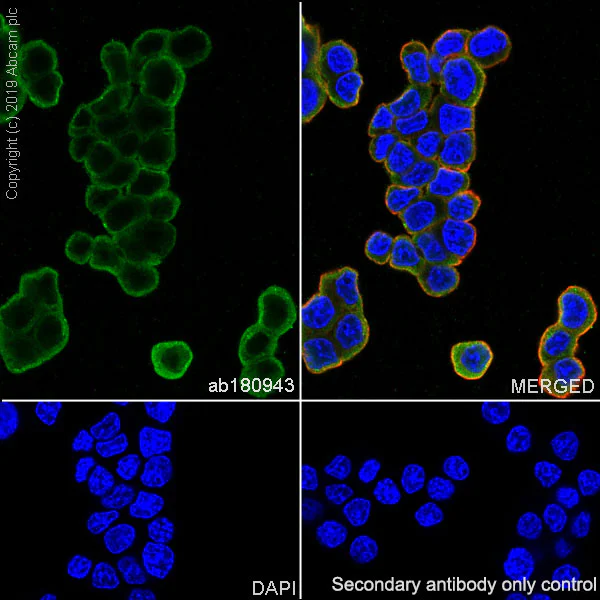 Immunocytochemistry/ Immunofluorescence - Anti-ENO1 + ENO2 + ENO3 antibody [EPR12483] (AB180943)