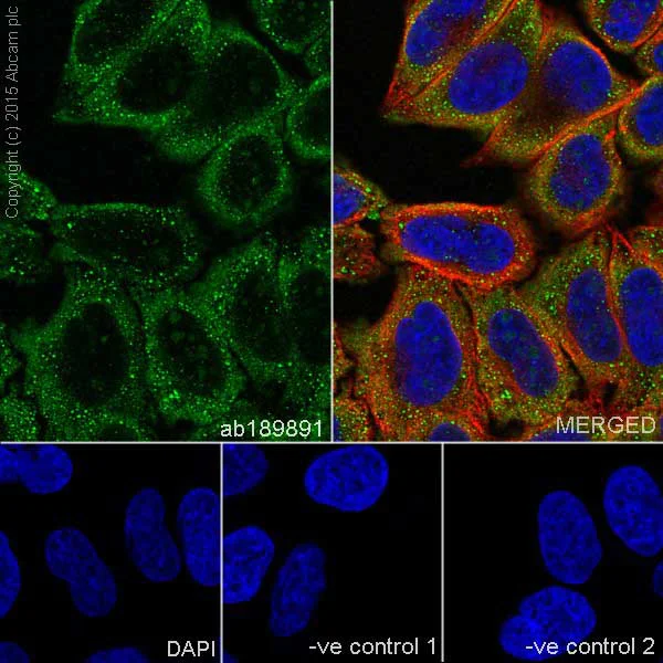 Immunocytochemistry/ Immunofluorescence - Anti-ENO1 + ENO2 + ENO3 antibody [EPR18407] - BSA and Azide free (AB250997)