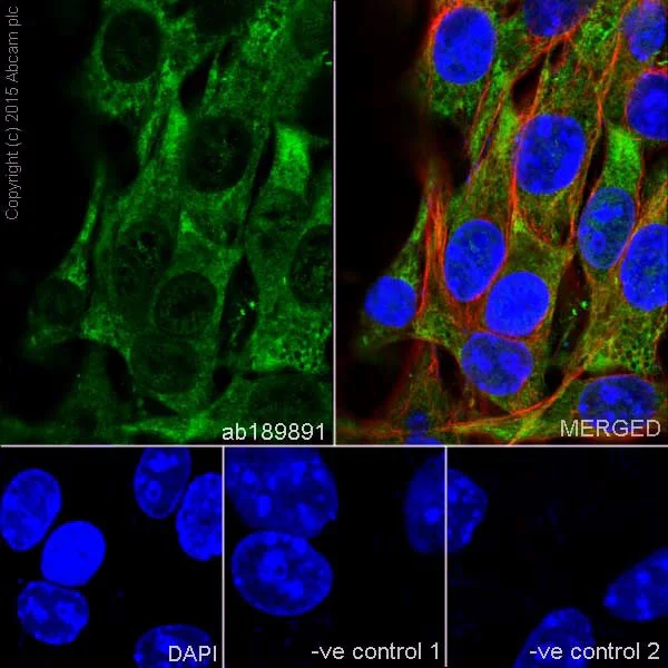 Immunocytochemistry/ Immunofluorescence - Anti-ENO1 + ENO2 + ENO3 antibody [EPR18407] - BSA and Azide free (AB250997)