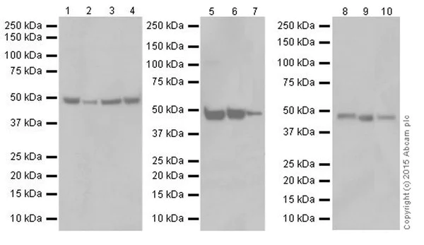 Western blot - Anti-ENO1 + ENO2 + ENO3 antibody [EPR18422] (AB189892)
