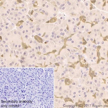 Immunohistochemistry (Formalin/PFA-fixed paraffin-embedded sections) - Anti-ENO1 + ENO2 + ENO3 antibody [EPR19680] (AB222514)