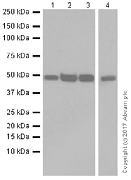 Western blot - Anti-ENO1 + ENO2 + ENO3 antibody [EPR19680] (AB222514)