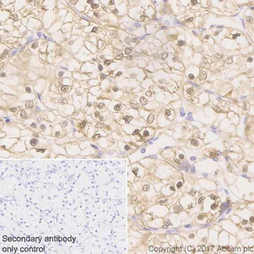 Immunohistochemistry (Formalin/PFA-fixed paraffin-embedded sections) - Anti-ENO1 + ENO2 + ENO3 antibody [EPR19680] - BSA and Azide free (AB251571)